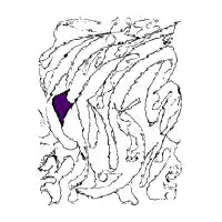 Epilepsy - design