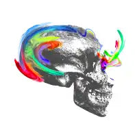 Crazy 'bout you - design