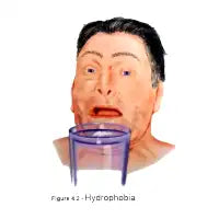 Hydrophobia - design