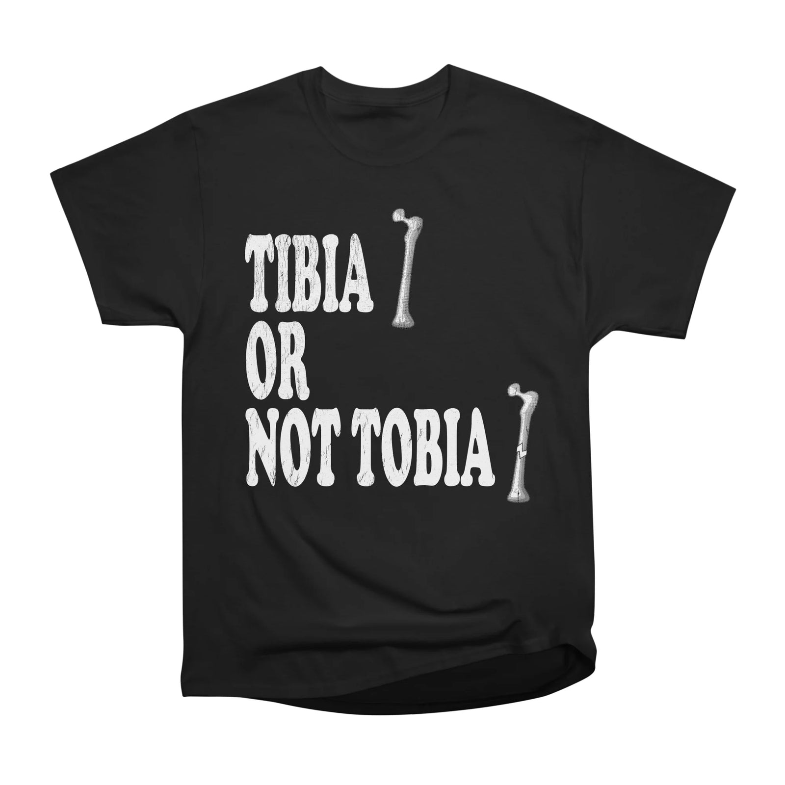 Tibia Or Not Tibia - Radiologist, Anatomy